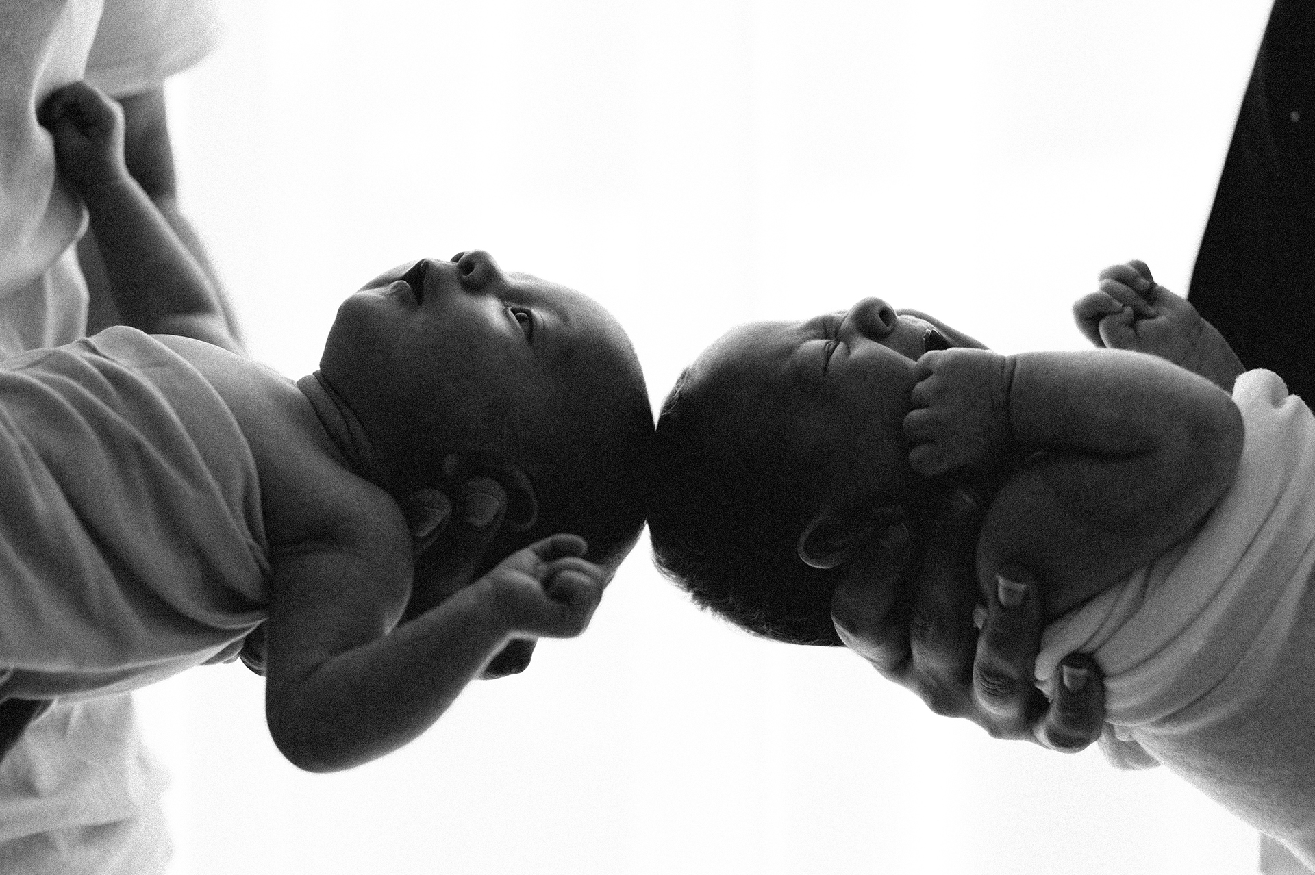 due neonati gemelli con la testa ravvicinata